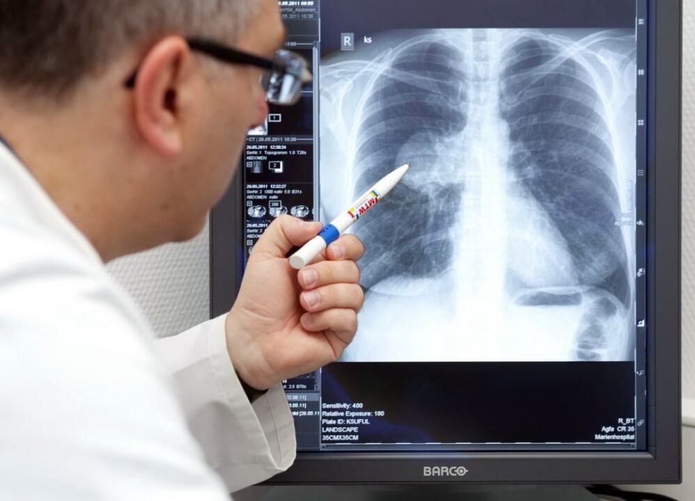diagnosi di ipertensione arteriosa